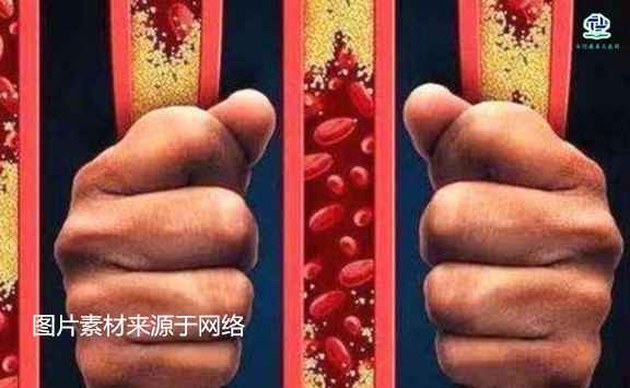 不想給血管“添堵”，盡量少吃以下這些東西，或許能讓腦梗離遠(yuǎn)些  